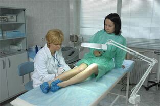 Terapie cu laser pentru varice la nivelul picioarelor