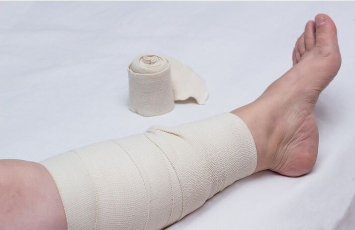 bandaj de compresie pe picior pentru varice