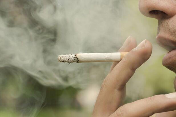 Fumatul este unul dintre motivele dezvoltării venelor varicoase reticulare